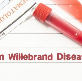 Enfermedad de Von Willebrand